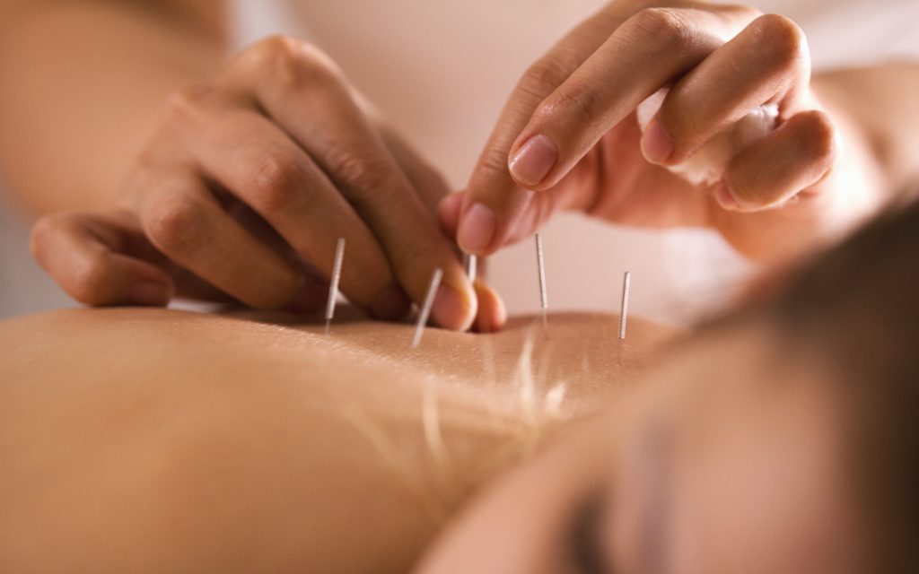Top services of acupuncture clinics in Dubai