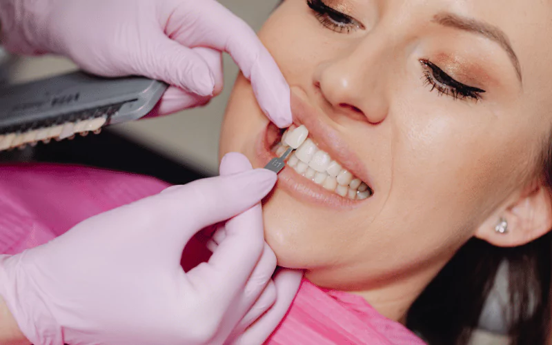 Restoring More Than Teeth: The Confidence Boost Of Cosmetic
