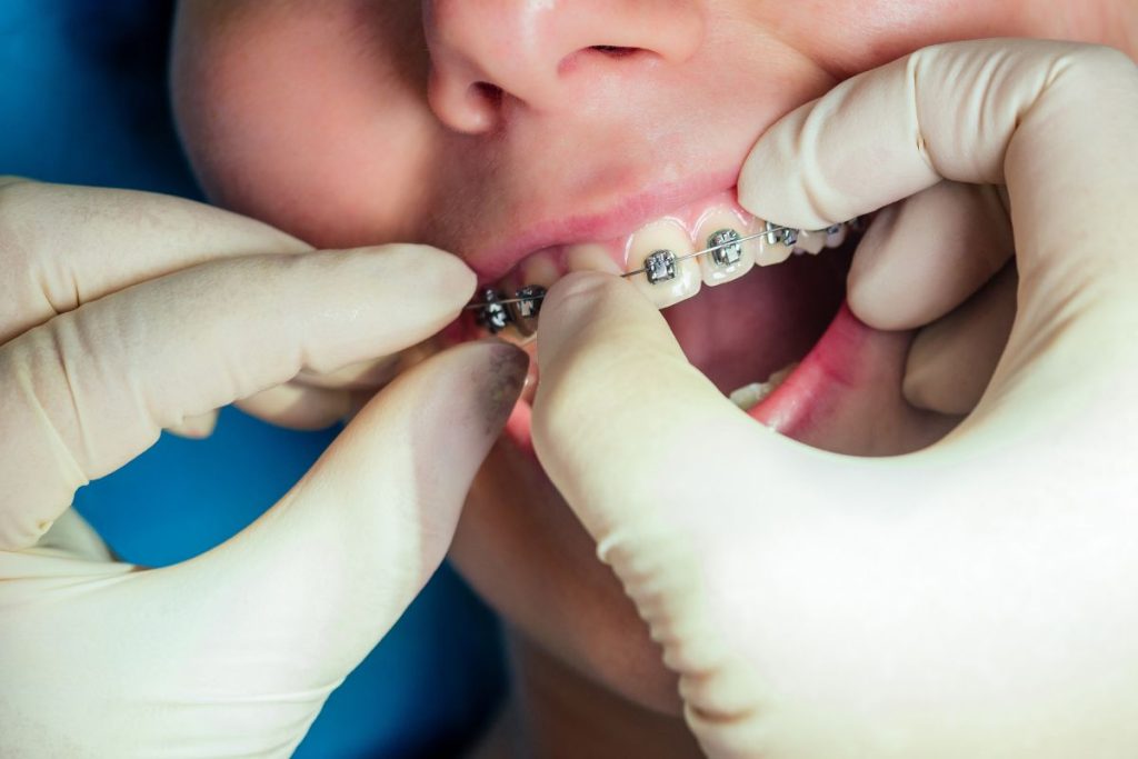 4 Benefits Of Starting Orthodontics At A Family Dental Practice