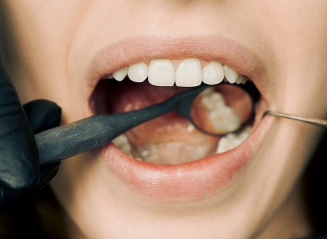 The Importance of Routine Dental Check-Ups and Cleaning