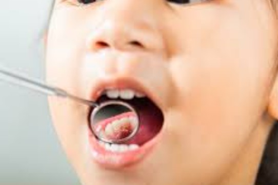 Why Regular Checkups Are The Best Protection Against Cavities
